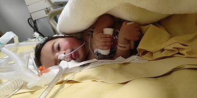 SMA TİP-1 Ölümcül kas hastası Dua İkra bebek desteklerinizi bekliyor
