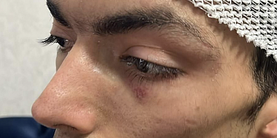 SON DAKİKA: Gaziantep’te Bakım Evinde Skandal!